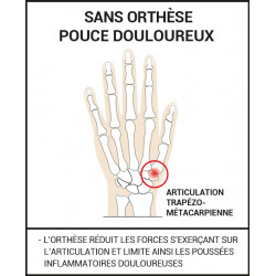 EPITACT ORTHÈSE POUCE RHIZARTHROSE - Droit Taille S